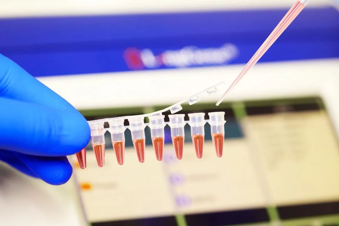 PCR/qPCR 소모품을 선택하는 방법은 무엇입니까?